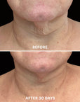 Glo Skin Beauty Bio-Renew EGF Neck Cream Kaklo ir dekolte kremas